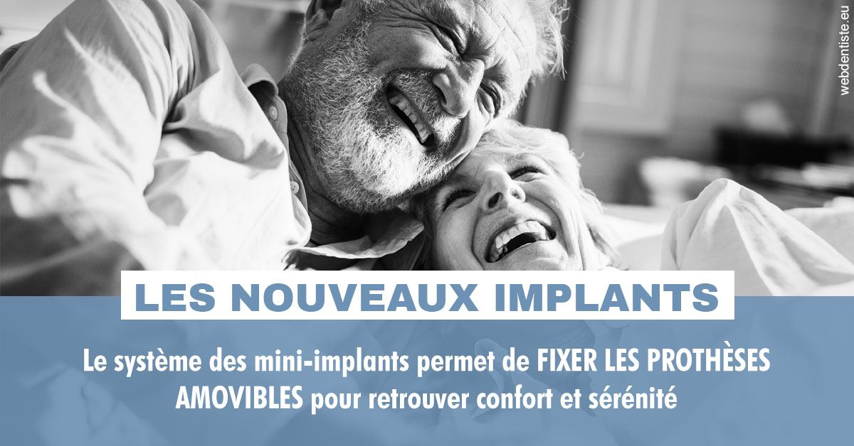 https://dent1ste.fr/Les nouveaux implants 2