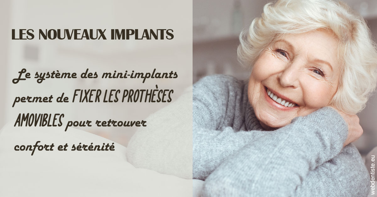 https://dent1ste.fr/Les nouveaux implants 1