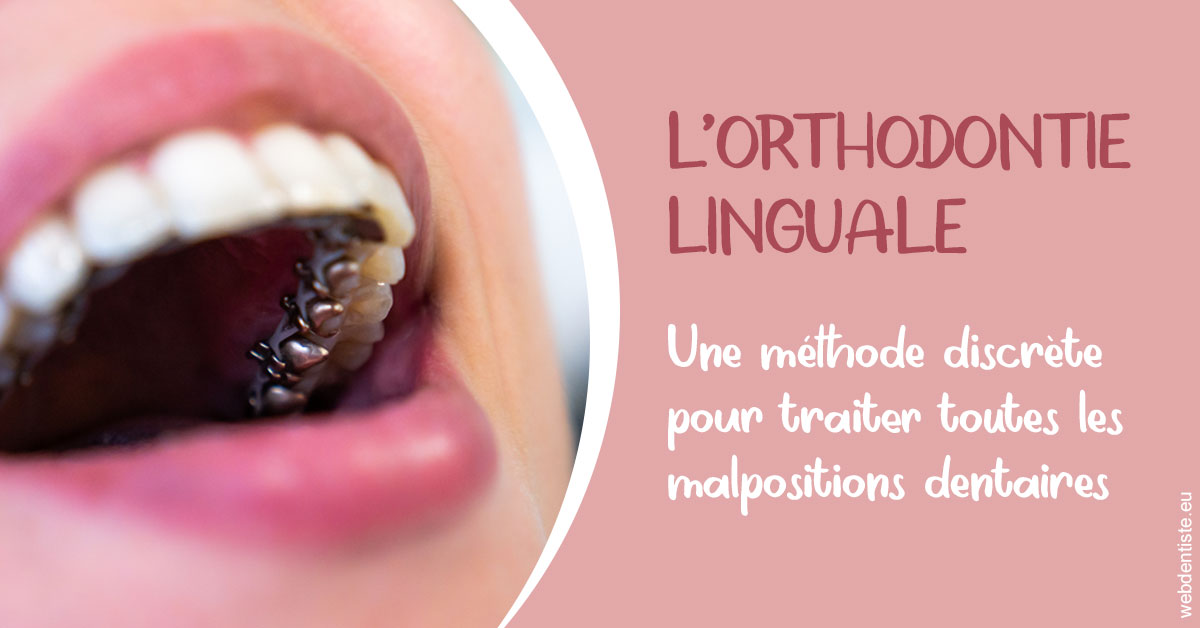 https://dent1ste.fr/L'orthodontie linguale 2