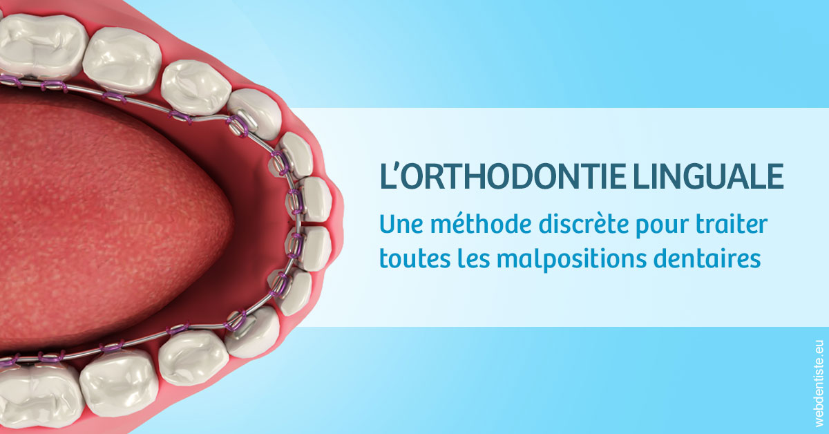 https://dent1ste.fr/L'orthodontie linguale 1