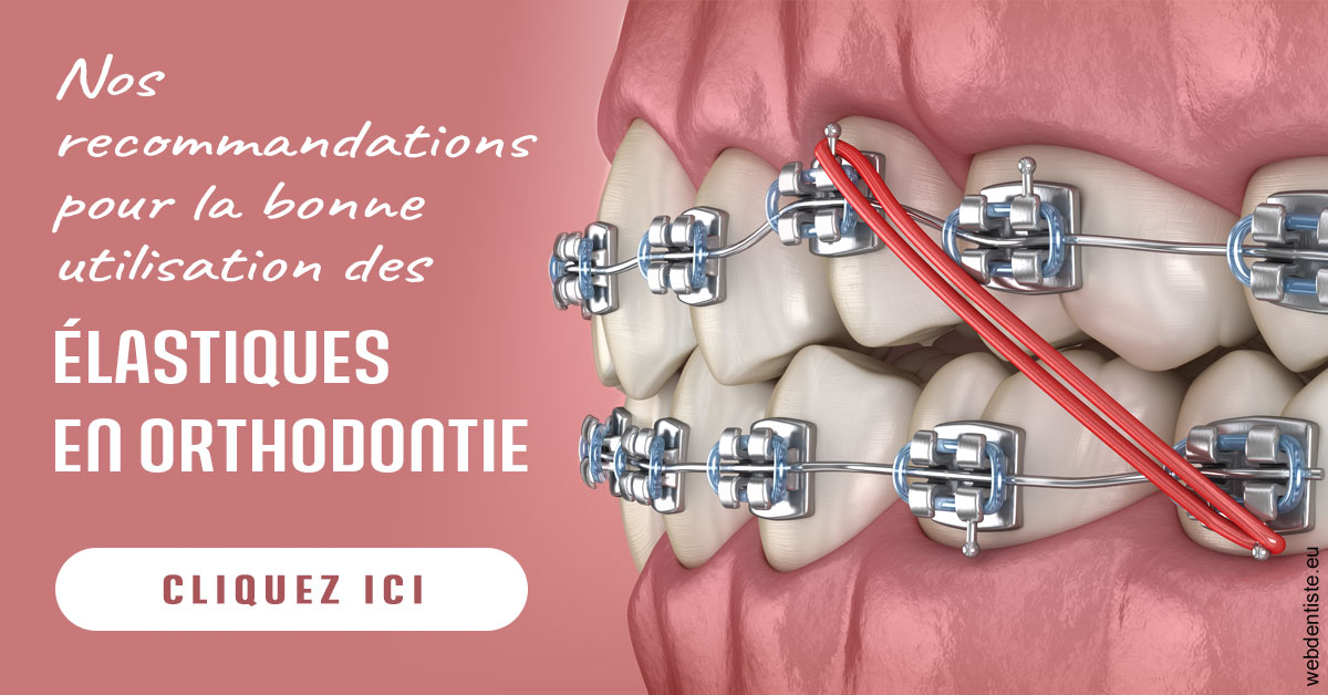https://dent1ste.fr/Elastiques orthodontie 2